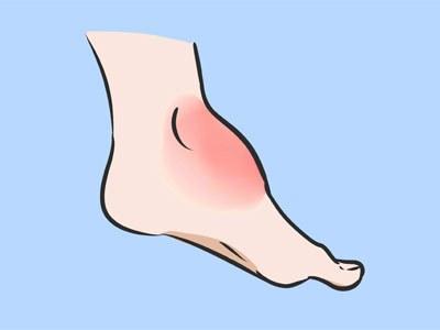 孩子外出踏春游玩扭伤脚专家教你如何科学应对