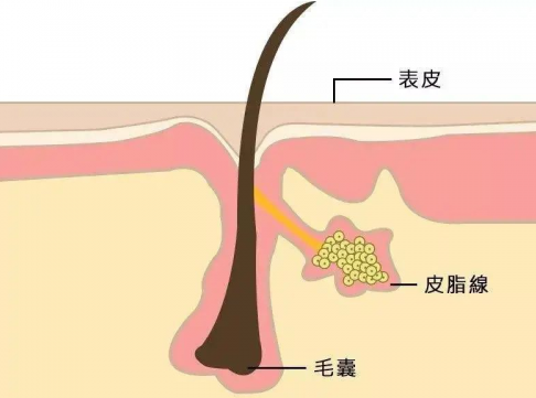 皮脂腺分泌还与温度,过油腻饮食都会让皮脂腺分泌旺盛~~~头部皮脂腺
