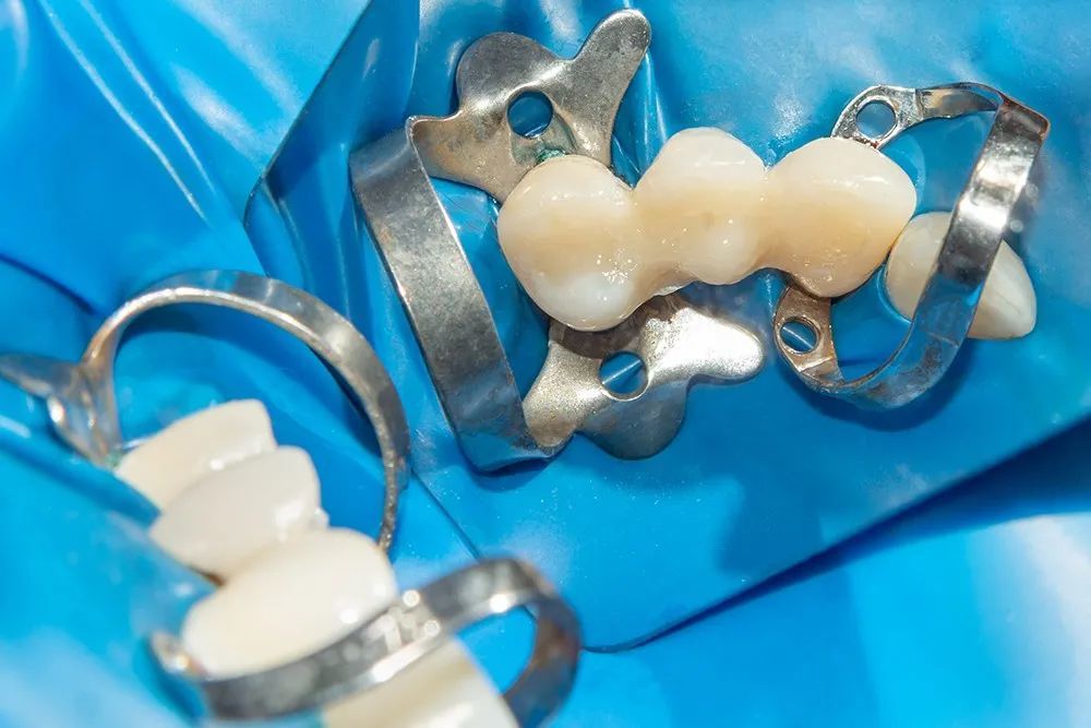 三种修复方式详解,帮您轻松选好牙!