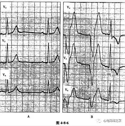 心电图试题练习122