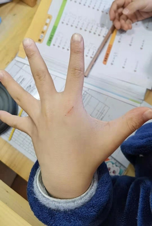 撸猫馆"喵星人"抓伤宝宝,有的赔有的不肯赔