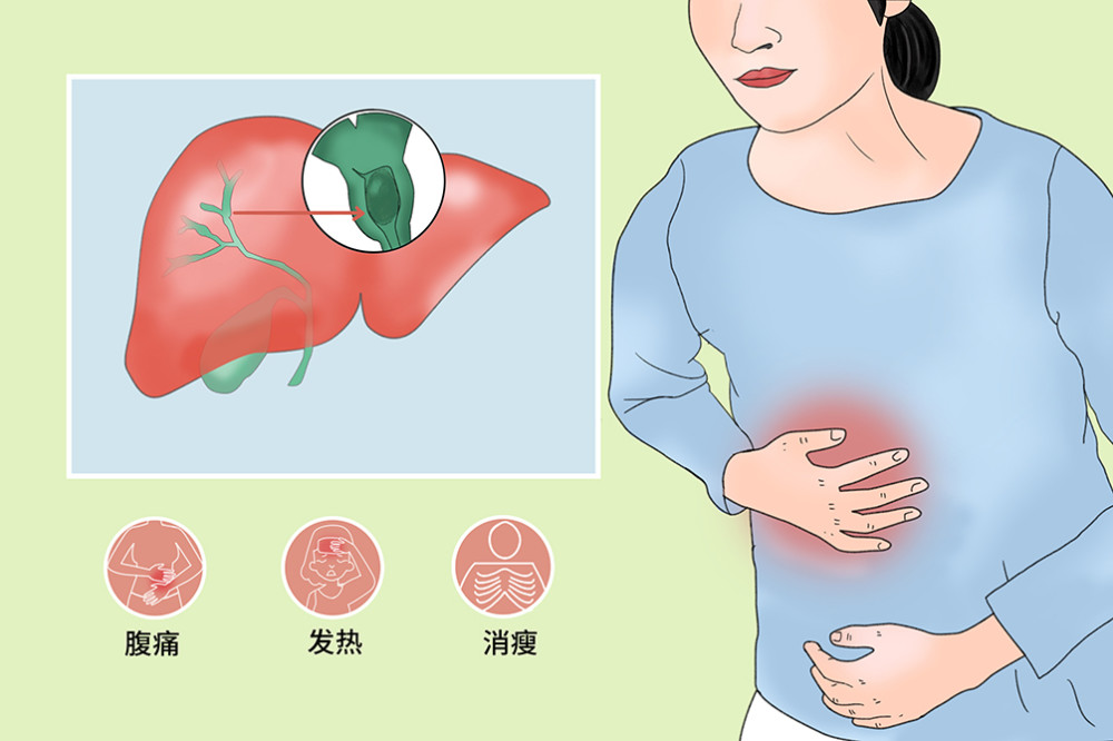 介入治疗原装生活梗阻性黄疸介入治疗篇