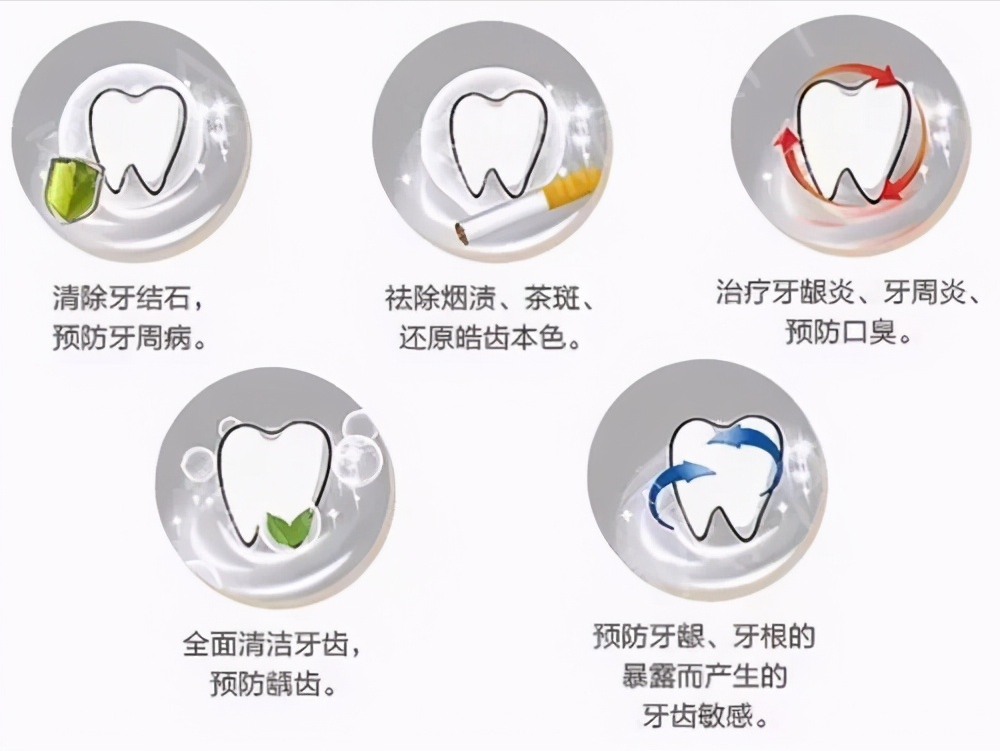 洗牙真的是用洗的嗎幾個你不知道的洗牙小知識來看看