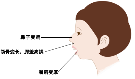 孩子總是張口呼吸家長需警惕的不良習慣