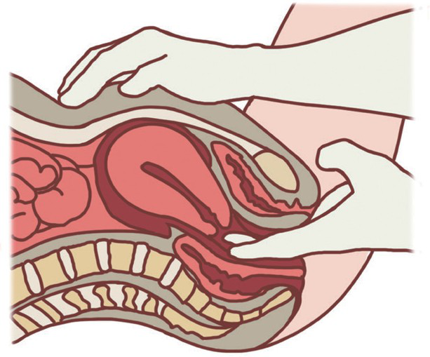 妇科检查都查什么