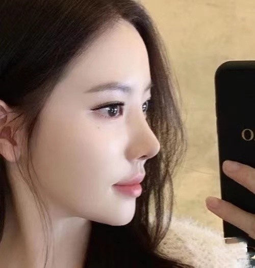 瘦鼻子的有效方法是什么几个小方法让鼻子更小巧