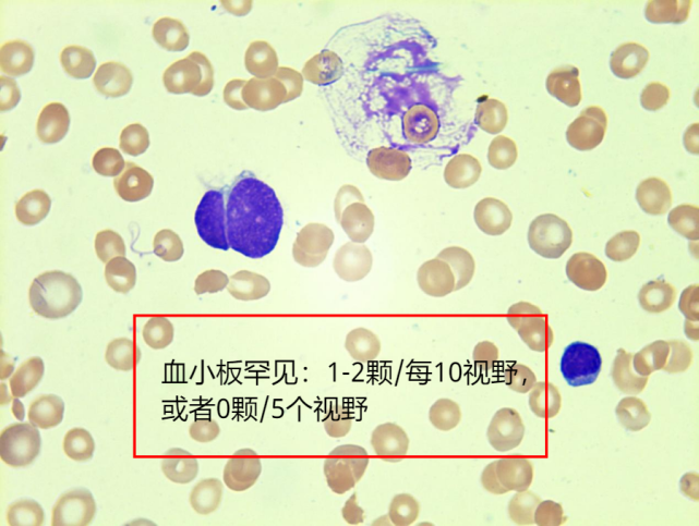 形态学报告中血小板应该如何描述｜经验分享_腾讯新闻