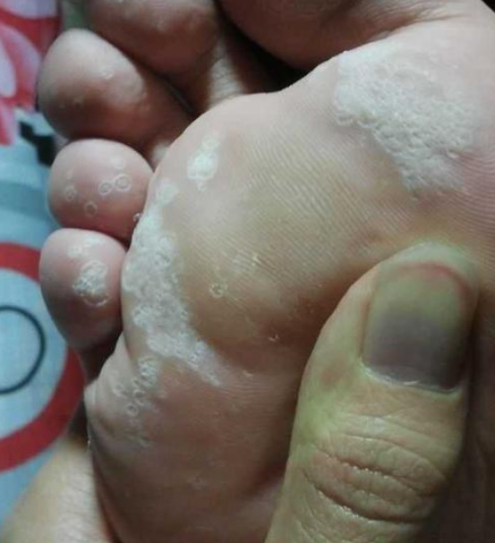 李佳琦1分钟爆卖30万双这双巨火的踩屎感拖鞋防污防滑不臭脚穿上真的