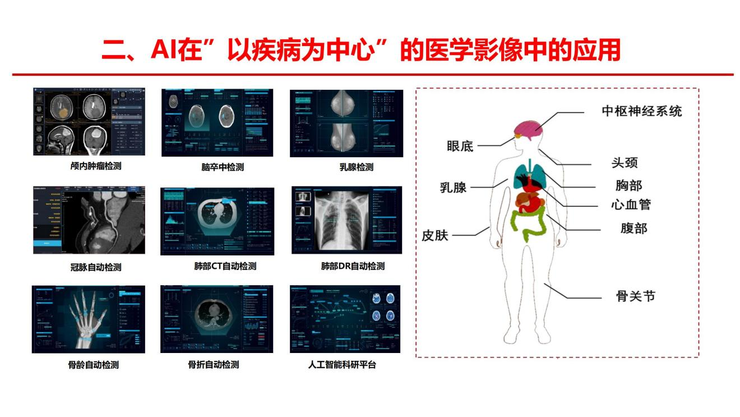 可以作為一種收費形式進入醫院,既能體現人工智能價值,又能體現醫生