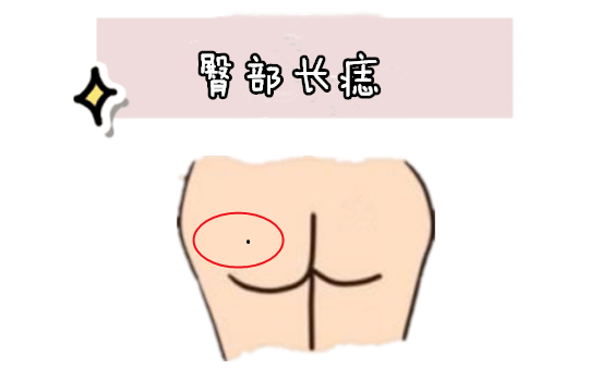女人4颗旺夫痣,婚前不愁钱,婚后有人疼,成就丈夫,带旺儿女!