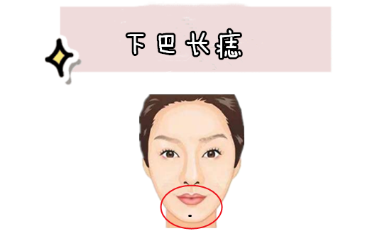 女人的眉尾处长有吉痣,则有"喜上眉梢"的意思,往往大多数的情况下