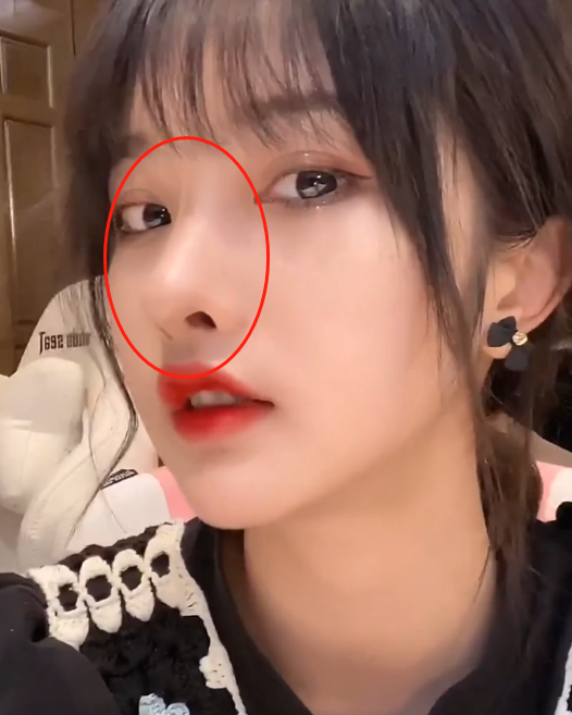 次惑小仙女跟可乐分手后,终于取出鼻子里的假体,颜值重回巅峰时期