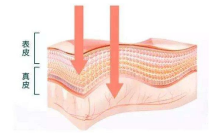 從理論上講護膚品是在皮膚表皮層發揮作用的,很難被吸收進真皮層,只有