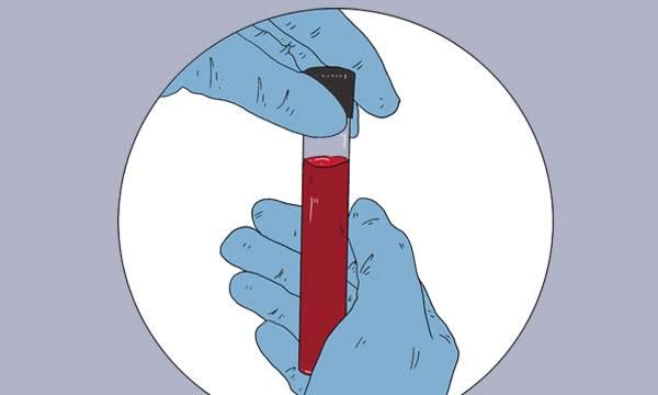 做血脂检查其他指标合格只有甘油三酯升高说明什么