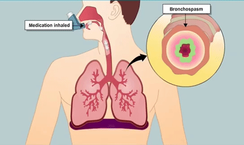 药格分裂它既是雾化药也是多国拉黑的违禁品