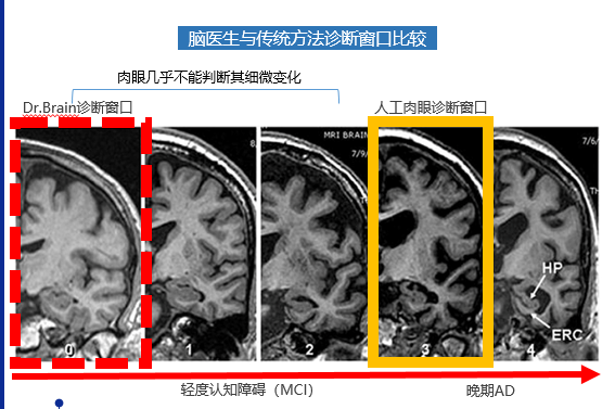 AI医疗热度不减，智能影像的“盘子”到底有多大？-智医疗网