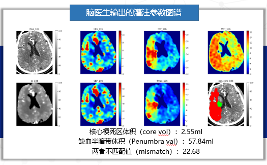 AI医疗热度不减，智能影像的“盘子”到底有多大？-智医疗网