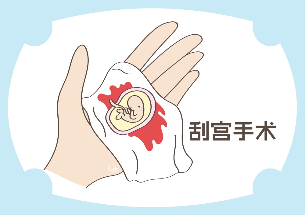 有没做过流产其实是有差别的67从这些地方可以看出
