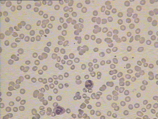 红细胞凝集素图片