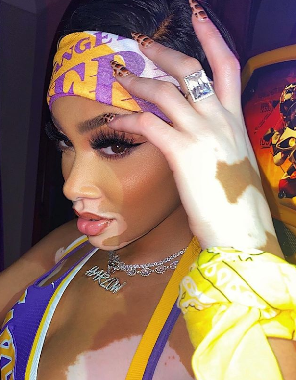 引领时尚还是不尊敬?库兹马白癜风超模女友将湖人球衣剪碎 改造