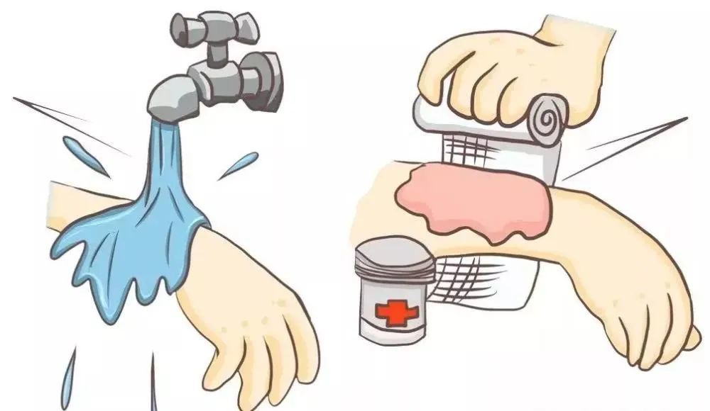 23,烫伤的水疱切勿穿破,保持伤面清洁,已破者暴露要涂些烧伤药膏,抗菌