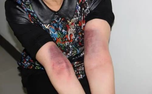 世上本无癌,只是瘀和堵_腾讯新闻