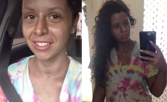 想要健康小麦色醉酒美容师上门美黑后美国女子全身黝黑发亮