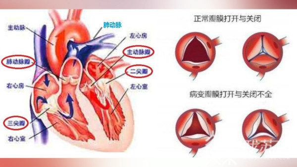 心脏瓣膜 位置图图片