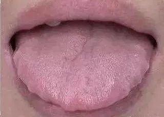 拍打这里49下全身湿气都排空