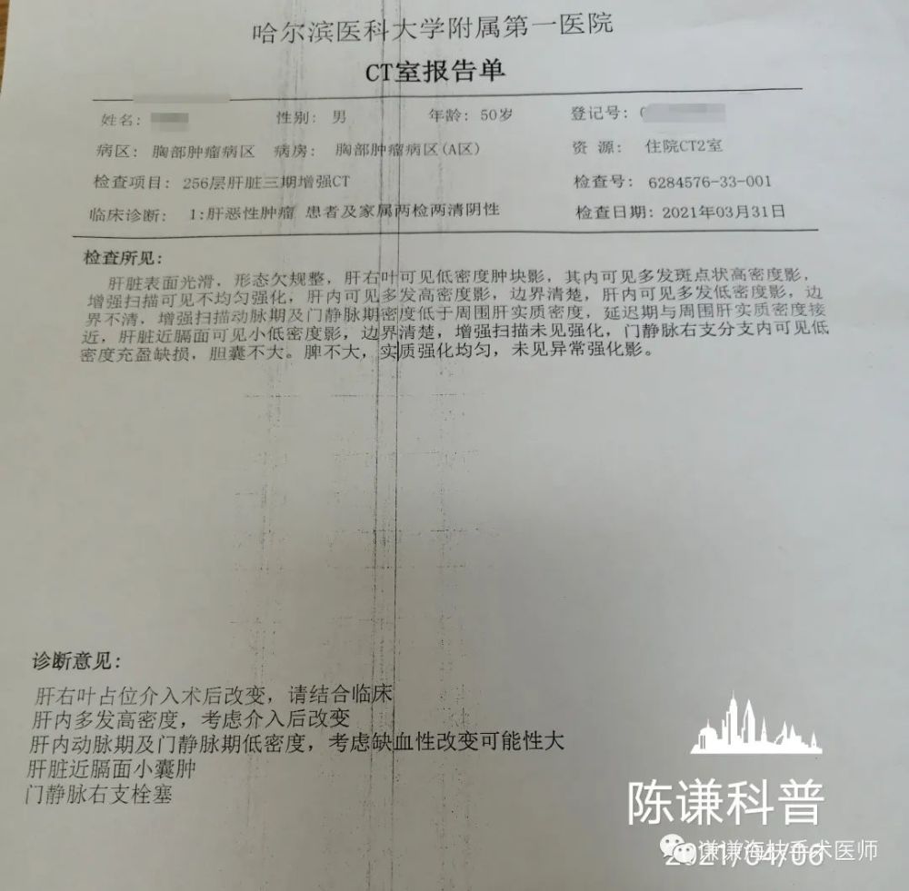 肝癌伴门脉癌栓病例