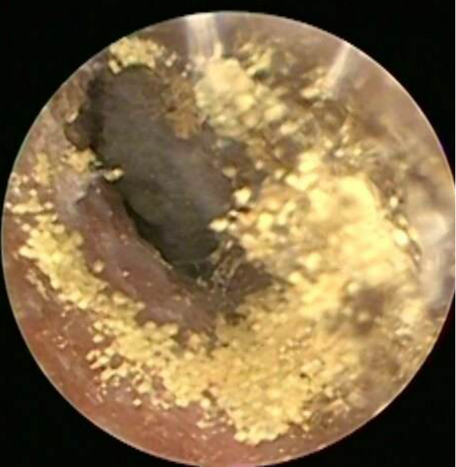 耳朵白色霉菌照片图片