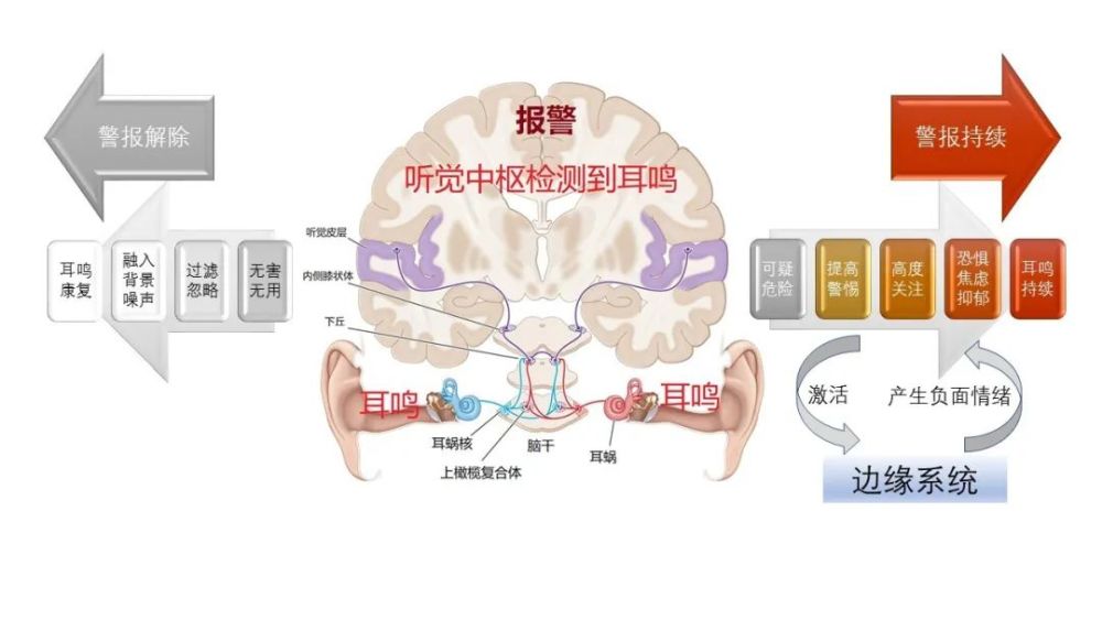 耳鸣太烦人经常耳鸣要怎么治疗