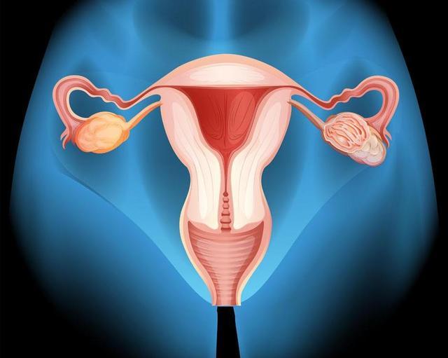 这5类食物会加速女性子宫衰老若爱吃坚持这项运动或能改善