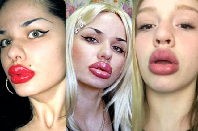 如何拥有一个性感厚唇?