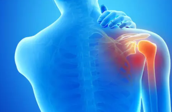 肩周炎是什么位置图片