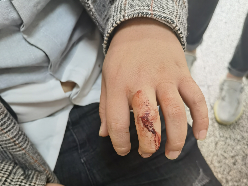 徒手夺刀邵阳一派出所长和95后辅警抓获持刀歹徒事后