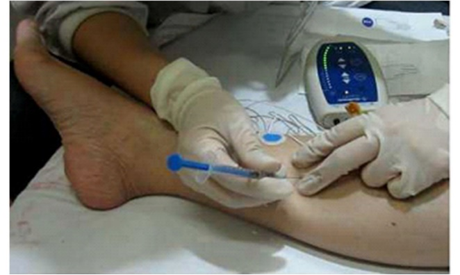 得了帕金森病后足部痉挛怎么办