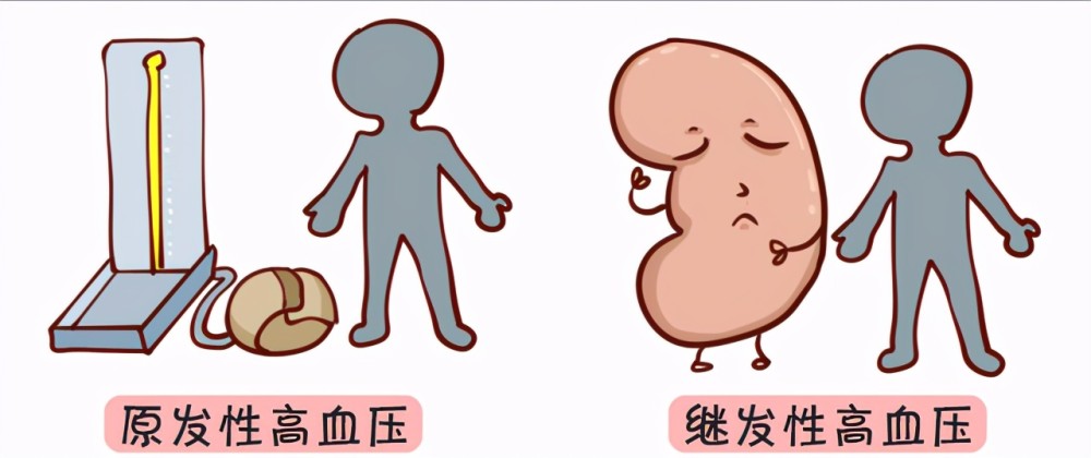 高血压可分为:原发性高血压和继发性高血压首先来介绍一下高血压的