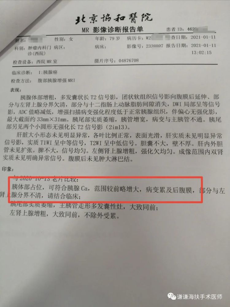 晚期胰腺癌疼痛病例解析