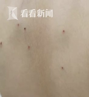 小学生被同学用铅笔戳出20多处伤最新进展来了