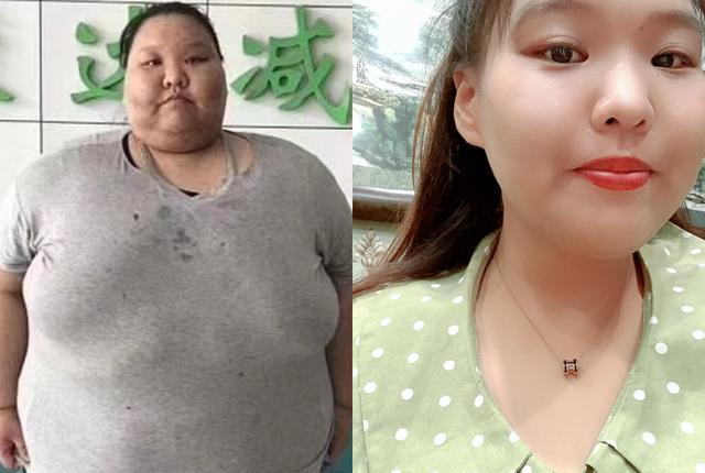 400斤胖妹减掉二百斤,亲妈差点认不出,这项运动功劳大_腾讯新闻