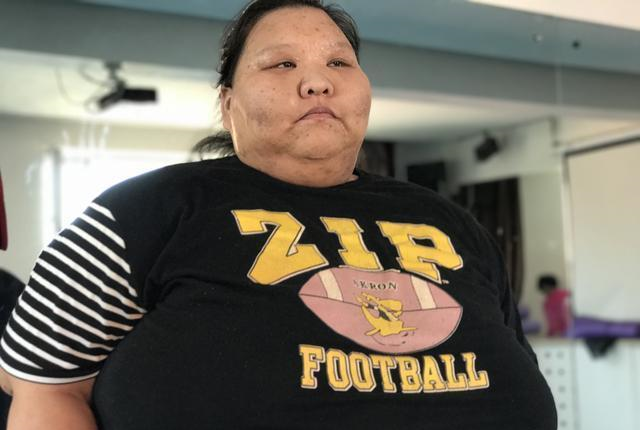 400斤胖妹减掉二百斤亲妈差点认不出这项运动功劳大