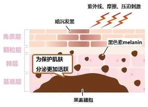 露胳膊露腿的季节到了 你的胳膊肘这么黑 腾讯新闻