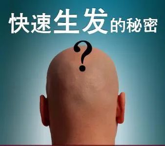 脂溢性脱发怎么办?脱发防治有诀窍!