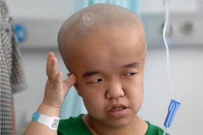 刚出生男孩变大头娃娃只因喝了三鹿牌奶粉12年过去痛苦依旧在