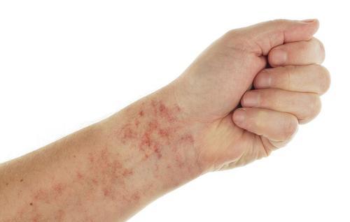 乙肝最终发展成癌吗肝病主任做到这3点让癌症远离你