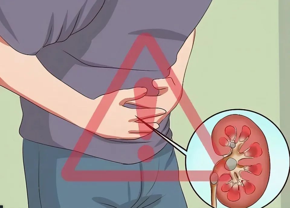 肾衰竭,尿毒症为何越来越多?除了烟和酒,三件事也是"帮凶"