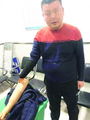 这个司机开车一只手戴手套很可疑一查竟是只假手