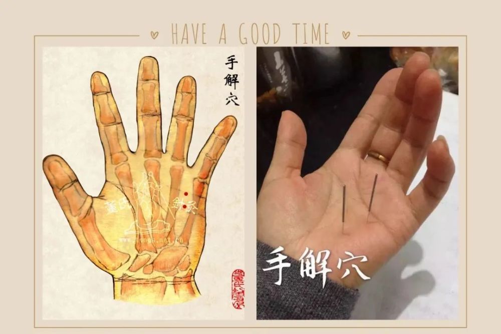 针方董氏针灸肾结石针法处方