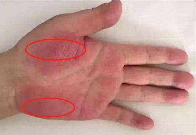 肝好不好看手就知道若没有这三个变化偷着乐吧